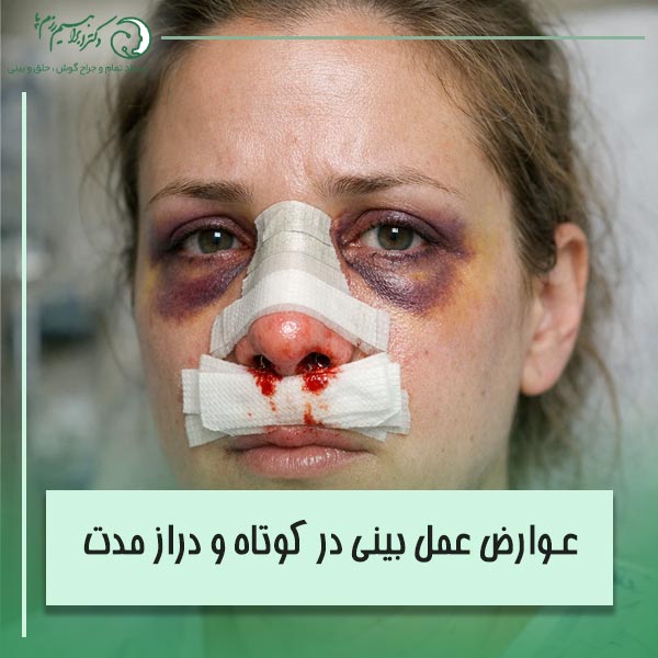مهمترین عوارض جراحی بینی (عوارض عمل بینی در کوتاه و دراز مدت)