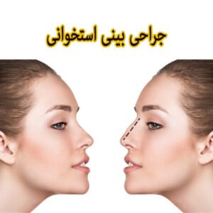 جراحی بینی استخوانی در تهران - دکتر رزم پا