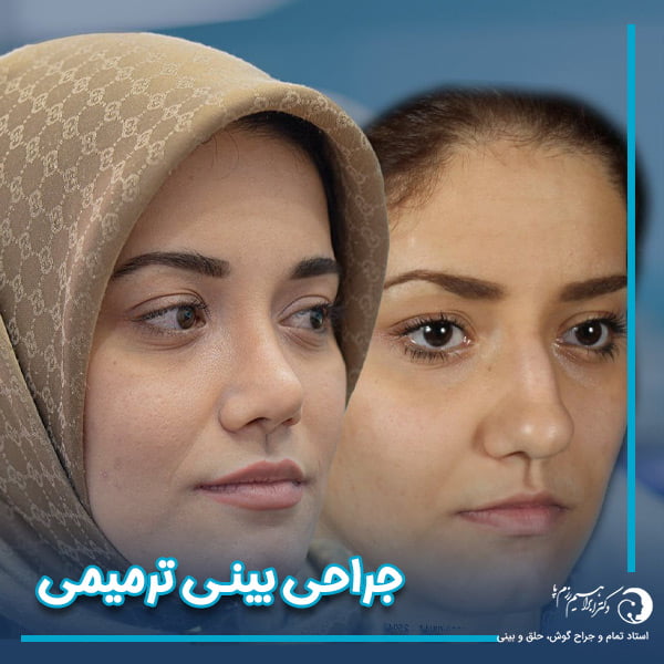 جراحی بینی ترمیمی + دکتر ابراهیم رزم پا