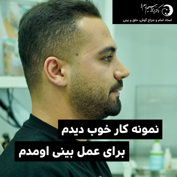 عمل بینی در تهران https://razmpa.com/
