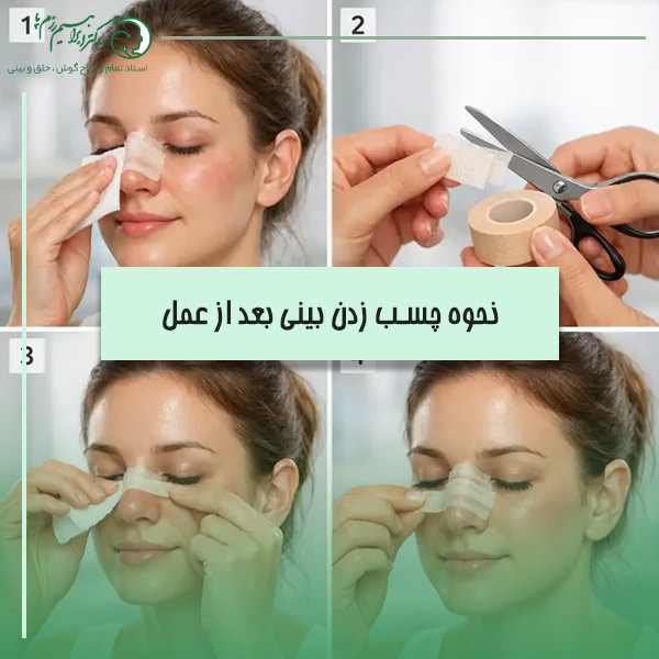 نحوه چسب زدن به بینی بعد از جراحی + مزایا چسب بینی بعد عمل