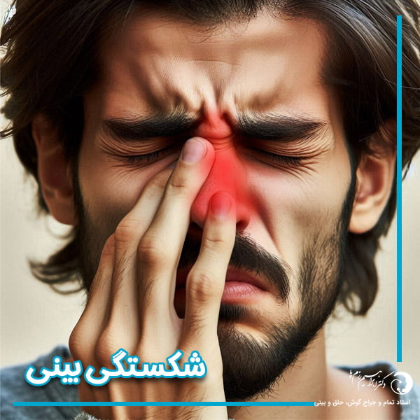 شکستگی بینی + جراحی بینی شکسته