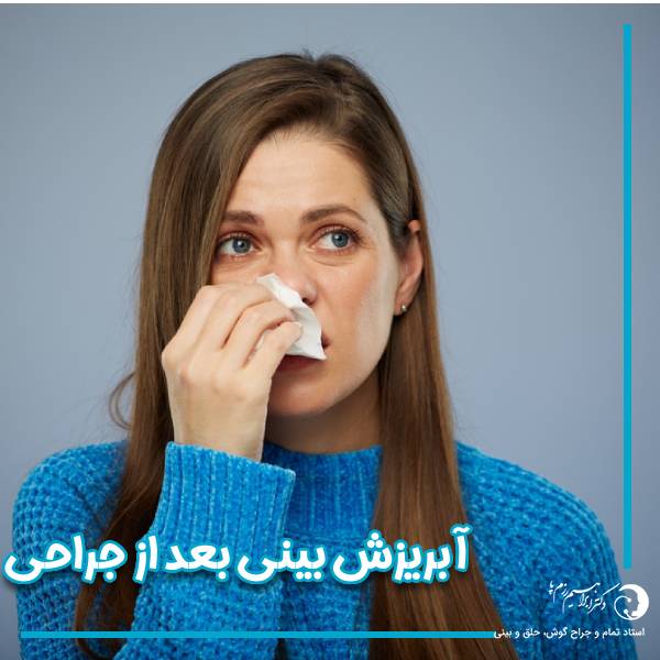 آبریزش بینی بعد از جراحی