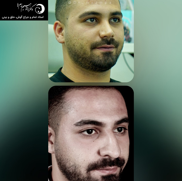 عمل بینی در تهران https://razmpa.com/