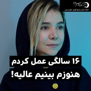 عکس نمونه کار بهترین جراح بینی تهران- دکتر رزم پا-razmpa.com