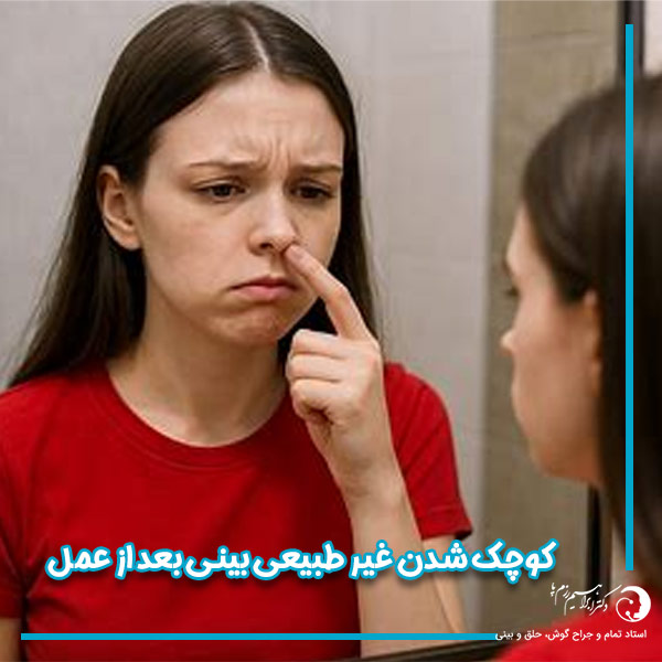 کوچک شدن غیر طبیعی بینی بعد از عمل - دکتر رزم پا - /razmpa.com