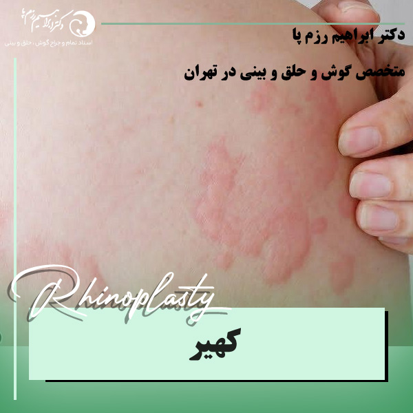کهیر