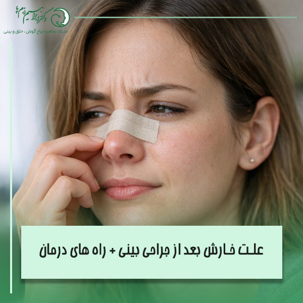 علت خارش بعد از جراحی بینی + راه های درمان خارش بینی بعد از عمل